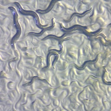 Several nematodes under microscopic imaging